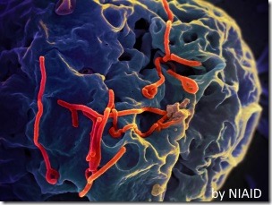 エボラ出血熱のウイルス